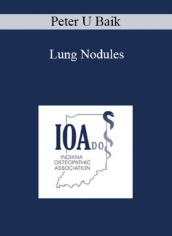 Peter U Baik - Lung Nodules